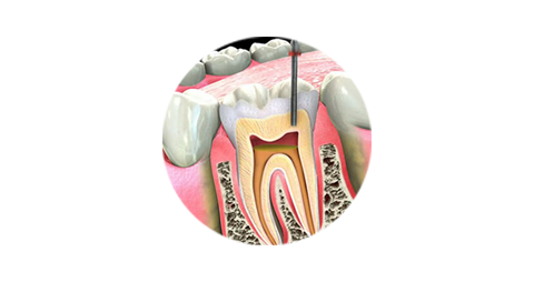 Breast Cancer Treatment in Chennai ,Thyroid  Cancer Treatment in Chennai, Surgical Oncologist Cancer Treatment in Chennai, Gastroenterology  in Chennai, Laparoscopic Surgery in Chennai,  Dentist in Chennai, Dental Clinic in Chennai, Dental in Chennai, Root Canal Treatment in Chennai,  endocrinologist in Chennai, Psychiatrist  in Chennai  Endodontist in Chennai, Breast Cancer Treatment in Purasawalkam Chennai ,Thyroid  Cancer Treatment in Purasawalkam Chennai, Surgical Oncologist Cancer Treatment in Purasawalkam Chennai, Gastroenterology  in Purasawalkam Chennai, Laparoscopic Surgery in Purasawalkam Chennai,  Dentist in Purasawalkam Chennai, Dental Clinic in Purasawalkam Chennai, Dental in Purasawalkam Chennai, Root Canal Treatment in Purasawalkam Chennai,  endocrinologist in Purasawalkam Chennai, Psychiatrist  in Purasawalkam Chennai  Endodontist in Purasawalkam Chennai, Breast Cancer Treatment in Vepery Chennai  ,Thyroid  Cancer Treatment in Vepery Chennai, Surgical Oncologist Cancer Treatment in Vepery Chennai, Gastroenterology  in Vepery Chennai, Laparoscopic Surgery in Vepery Chennai,  Dentist in Vepery Chennai, Dental Clinic in Vepery Chennai, Dental in Vepery Chennai, Root Canal Treatment in Vepery Chennai,  endocrinologist in Vepery Chennai, Psychiatrist  in Vepery Chennai  Endodontist in Vepery Chennai, , Breast Cancer Treatment in kilpauk Chennai  ,Thyroid  Cancer Treatment in kilpauk Chennai, Surgical Oncologist Cancer Treatment in kilpauk Chennai, Gastroenterology  in kilpauk Chennai, Laparoscopic Surgery in kilpauk Chennai,  Dentist in kilpauk Chennai, Dental Clinic in kilpauk Chennai, Dental in kilpauk Chennai, Root Canal Treatment in kilpauk Chennai,  endocrinologist in kilpauk Chennai, Psychiatrist  in kilpauk Chennai,  Endodontist in kilpauk Chennai, Breast Cancer Treatment in kellys Chennai  ,Thyroid  Cancer Treatment in kellys Chennai, Surgical Oncologist Cancer Treatment in kellys Chennai, Gastroenterology  in kellys Chennai, Laparoscopic Surgery in kellys Chennai,  Dentist in kellys Chennai, Dental Clinic in kellys Chennai, Dental in kellys Chennai, Root Canal Treatment in kellys Chennai,  endocrinologist in kellys Chennai, Psychiatrist  in kellys Chennai,  Endodontist in kellys Chennai