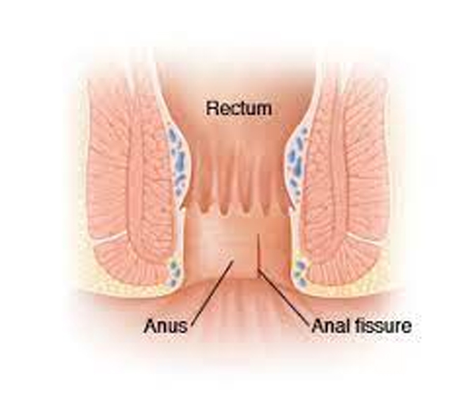 Breast Cancer Treatment in Chennai ,Thyroid  Cancer Treatment in Chennai, Surgical Oncologist Cancer Treatment in Chennai, Gastroenterology  in Chennai, Laparoscopic Surgery in Chennai,  Dentist in Chennai, Dental Clinic in Chennai, Dental in Chennai, Root Canal Treatment in Chennai,  endocrinologist in Chennai, Psychiatrist  in Chennai  Endodontist in Chennai, Breast Cancer Treatment in Purasawalkam Chennai ,Thyroid  Cancer Treatment in Purasawalkam Chennai, Surgical Oncologist Cancer Treatment in Purasawalkam Chennai, Gastroenterology  in Purasawalkam Chennai, Laparoscopic Surgery in Purasawalkam Chennai,  Dentist in Purasawalkam Chennai, Dental Clinic in Purasawalkam Chennai, Dental in Purasawalkam Chennai, Root Canal Treatment in Purasawalkam Chennai,  endocrinologist in Purasawalkam Chennai, Psychiatrist  in Purasawalkam Chennai  Endodontist in Purasawalkam Chennai, Breast Cancer Treatment in Vepery Chennai  ,Thyroid  Cancer Treatment in Vepery Chennai, Surgical Oncologist Cancer Treatment in Vepery Chennai, Gastroenterology  in Vepery Chennai, Laparoscopic Surgery in Vepery Chennai,  Dentist in Vepery Chennai, Dental Clinic in Vepery Chennai, Dental in Vepery Chennai, Root Canal Treatment in Vepery Chennai,  endocrinologist in Vepery Chennai, Psychiatrist  in Vepery Chennai  Endodontist in Vepery Chennai, , Breast Cancer Treatment in kilpauk Chennai  ,Thyroid  Cancer Treatment in kilpauk Chennai, Surgical Oncologist Cancer Treatment in kilpauk Chennai, Gastroenterology  in kilpauk Chennai, Laparoscopic Surgery in kilpauk Chennai,  Dentist in kilpauk Chennai, Dental Clinic in kilpauk Chennai, Dental in kilpauk Chennai, Root Canal Treatment in kilpauk Chennai,  endocrinologist in kilpauk Chennai, Psychiatrist  in kilpauk Chennai,  Endodontist in kilpauk Chennai, Breast Cancer Treatment in kellys Chennai  ,Thyroid  Cancer Treatment in kellys Chennai, Surgical Oncologist Cancer Treatment in kellys Chennai, Gastroenterology  in kellys Chennai, Laparoscopic Surgery in kellys Chennai,  Dentist in kellys Chennai, Dental Clinic in kellys Chennai, Dental in kellys Chennai, Root Canal Treatment in kellys Chennai,  endocrinologist in kellys Chennai, Psychiatrist  in kellys Chennai,  Endodontist in kellys Chennai