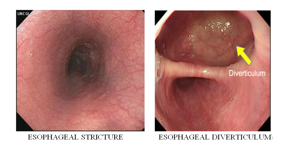 Breast Cancer Treatment in Chennai ,Thyroid  Cancer Treatment in Chennai, Surgical Oncologist Cancer Treatment in Chennai, Gastroenterology  in Chennai, Laparoscopic Surgery in Chennai,  Dentist in Chennai, Dental Clinic in Chennai, Dental in Chennai, Root Canal Treatment in Chennai,  endocrinologist in Chennai, Psychiatrist  in Chennai  Endodontist in Chennai, Breast Cancer Treatment in Purasawalkam Chennai ,Thyroid  Cancer Treatment in Purasawalkam Chennai, Surgical Oncologist Cancer Treatment in Purasawalkam Chennai, Gastroenterology  in Purasawalkam Chennai, Laparoscopic Surgery in Purasawalkam Chennai,  Dentist in Purasawalkam Chennai, Dental Clinic in Purasawalkam Chennai, Dental in Purasawalkam Chennai, Root Canal Treatment in Purasawalkam Chennai,  endocrinologist in Purasawalkam Chennai, Psychiatrist  in Purasawalkam Chennai  Endodontist in Purasawalkam Chennai, Breast Cancer Treatment in Vepery Chennai  ,Thyroid  Cancer Treatment in Vepery Chennai, Surgical Oncologist Cancer Treatment in Vepery Chennai, Gastroenterology  in Vepery Chennai, Laparoscopic Surgery in Vepery Chennai,  Dentist in Vepery Chennai, Dental Clinic in Vepery Chennai, Dental in Vepery Chennai, Root Canal Treatment in Vepery Chennai,  endocrinologist in Vepery Chennai, Psychiatrist  in Vepery Chennai  Endodontist in Vepery Chennai, , Breast Cancer Treatment in kilpauk Chennai  ,Thyroid  Cancer Treatment in kilpauk Chennai, Surgical Oncologist Cancer Treatment in kilpauk Chennai, Gastroenterology  in kilpauk Chennai, Laparoscopic Surgery in kilpauk Chennai,  Dentist in kilpauk Chennai, Dental Clinic in kilpauk Chennai, Dental in kilpauk Chennai, Root Canal Treatment in kilpauk Chennai,  endocrinologist in kilpauk Chennai, Psychiatrist  in kilpauk Chennai,  Endodontist in kilpauk Chennai, Breast Cancer Treatment in kellys Chennai  ,Thyroid  Cancer Treatment in kellys Chennai, Surgical Oncologist Cancer Treatment in kellys Chennai, Gastroenterology  in kellys Chennai, Laparoscopic Surgery in kellys Chennai,  Dentist in kellys Chennai, Dental Clinic in kellys Chennai, Dental in kellys Chennai, Root Canal Treatment in kellys Chennai,  endocrinologist in kellys Chennai, Psychiatrist  in kellys Chennai,  Endodontist in kellys Chennai