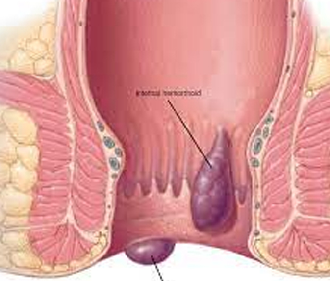 Breast Cancer Treatment in Chennai ,Thyroid  Cancer Treatment in Chennai, Surgical Oncologist Cancer Treatment in Chennai, Gastroenterology  in Chennai, Laparoscopic Surgery in Chennai,  Dentist in Chennai, Dental Clinic in Chennai, Dental in Chennai, Root Canal Treatment in Chennai,  endocrinologist in Chennai, Psychiatrist  in Chennai  Endodontist in Chennai, Breast Cancer Treatment in Purasawalkam Chennai ,Thyroid  Cancer Treatment in Purasawalkam Chennai, Surgical Oncologist Cancer Treatment in Purasawalkam Chennai, Gastroenterology  in Purasawalkam Chennai, Laparoscopic Surgery in Purasawalkam Chennai,  Dentist in Purasawalkam Chennai, Dental Clinic in Purasawalkam Chennai, Dental in Purasawalkam Chennai, Root Canal Treatment in Purasawalkam Chennai,  endocrinologist in Purasawalkam Chennai, Psychiatrist  in Purasawalkam Chennai  Endodontist in Purasawalkam Chennai, Breast Cancer Treatment in Vepery Chennai  ,Thyroid  Cancer Treatment in Vepery Chennai, Surgical Oncologist Cancer Treatment in Vepery Chennai, Gastroenterology  in Vepery Chennai, Laparoscopic Surgery in Vepery Chennai,  Dentist in Vepery Chennai, Dental Clinic in Vepery Chennai, Dental in Vepery Chennai, Root Canal Treatment in Vepery Chennai,  endocrinologist in Vepery Chennai, Psychiatrist  in Vepery Chennai  Endodontist in Vepery Chennai, , Breast Cancer Treatment in kilpauk Chennai  ,Thyroid  Cancer Treatment in kilpauk Chennai, Surgical Oncologist Cancer Treatment in kilpauk Chennai, Gastroenterology  in kilpauk Chennai, Laparoscopic Surgery in kilpauk Chennai,  Dentist in kilpauk Chennai, Dental Clinic in kilpauk Chennai, Dental in kilpauk Chennai, Root Canal Treatment in kilpauk Chennai,  endocrinologist in kilpauk Chennai, Psychiatrist  in kilpauk Chennai,  Endodontist in kilpauk Chennai, Breast Cancer Treatment in kellys Chennai  ,Thyroid  Cancer Treatment in kellys Chennai, Surgical Oncologist Cancer Treatment in kellys Chennai, Gastroenterology  in kellys Chennai, Laparoscopic Surgery in kellys Chennai,  Dentist in kellys Chennai, Dental Clinic in kellys Chennai, Dental in kellys Chennai, Root Canal Treatment in kellys Chennai,  endocrinologist in kellys Chennai, Psychiatrist  in kellys Chennai,  Endodontist in kellys Chennai