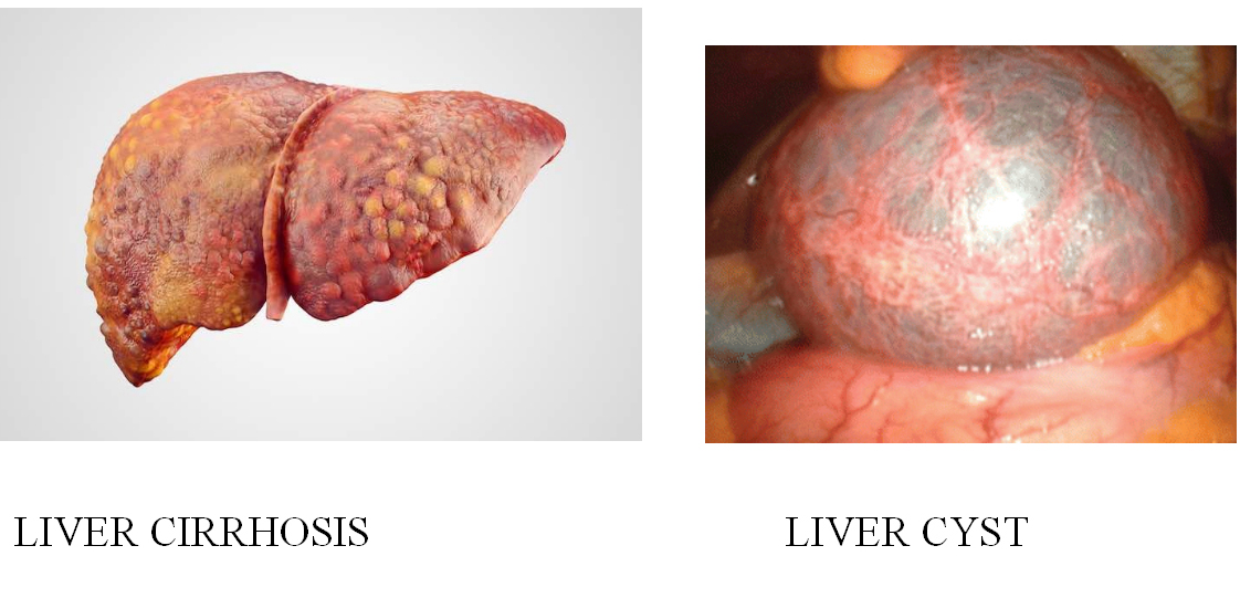 Breast Cancer Treatment in Chennai ,Thyroid  Cancer Treatment in Chennai, Surgical Oncologist Cancer Treatment in Chennai, Gastroenterology  in Chennai, Laparoscopic Surgery in Chennai,  Dentist in Chennai, Dental Clinic in Chennai, Dental in Chennai, Root Canal Treatment in Chennai,  endocrinologist in Chennai, Psychiatrist  in Chennai  Endodontist in Chennai, Breast Cancer Treatment in Purasawalkam Chennai ,Thyroid  Cancer Treatment in Purasawalkam Chennai, Surgical Oncologist Cancer Treatment in Purasawalkam Chennai, Gastroenterology  in Purasawalkam Chennai, Laparoscopic Surgery in Purasawalkam Chennai,  Dentist in Purasawalkam Chennai, Dental Clinic in Purasawalkam Chennai, Dental in Purasawalkam Chennai, Root Canal Treatment in Purasawalkam Chennai,  endocrinologist in Purasawalkam Chennai, Psychiatrist  in Purasawalkam Chennai  Endodontist in Purasawalkam Chennai, Breast Cancer Treatment in Vepery Chennai  ,Thyroid  Cancer Treatment in Vepery Chennai, Surgical Oncologist Cancer Treatment in Vepery Chennai, Gastroenterology  in Vepery Chennai, Laparoscopic Surgery in Vepery Chennai,  Dentist in Vepery Chennai, Dental Clinic in Vepery Chennai, Dental in Vepery Chennai, Root Canal Treatment in Vepery Chennai,  endocrinologist in Vepery Chennai, Psychiatrist  in Vepery Chennai  Endodontist in Vepery Chennai, , Breast Cancer Treatment in kilpauk Chennai  ,Thyroid  Cancer Treatment in kilpauk Chennai, Surgical Oncologist Cancer Treatment in kilpauk Chennai, Gastroenterology  in kilpauk Chennai, Laparoscopic Surgery in kilpauk Chennai,  Dentist in kilpauk Chennai, Dental Clinic in kilpauk Chennai, Dental in kilpauk Chennai, Root Canal Treatment in kilpauk Chennai,  endocrinologist in kilpauk Chennai, Psychiatrist  in kilpauk Chennai,  Endodontist in kilpauk Chennai, Breast Cancer Treatment in kellys Chennai  ,Thyroid  Cancer Treatment in kellys Chennai, Surgical Oncologist Cancer Treatment in kellys Chennai, Gastroenterology  in kellys Chennai, Laparoscopic Surgery in kellys Chennai,  Dentist in kellys Chennai, Dental Clinic in kellys Chennai, Dental in kellys Chennai, Root Canal Treatment in kellys Chennai,  endocrinologist in kellys Chennai, Psychiatrist  in kellys Chennai,  Endodontist in kellys Chennai