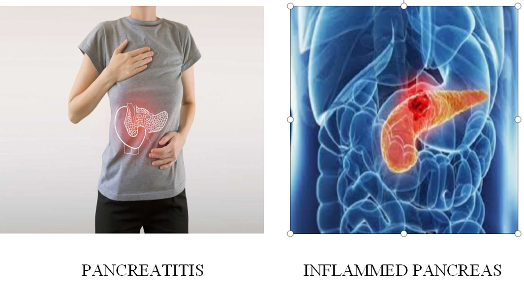 Breast Cancer Treatment in Chennai ,Thyroid  Cancer Treatment in Chennai, Surgical Oncologist Cancer Treatment in Chennai, Gastroenterology  in Chennai, Laparoscopic Surgery in Chennai,  Dentist in Chennai, Dental Clinic in Chennai, Dental in Chennai, Root Canal Treatment in Chennai,  endocrinologist in Chennai, Psychiatrist  in Chennai  Endodontist in Chennai, Breast Cancer Treatment in Purasawalkam Chennai ,Thyroid  Cancer Treatment in Purasawalkam Chennai, Surgical Oncologist Cancer Treatment in Purasawalkam Chennai, Gastroenterology  in Purasawalkam Chennai, Laparoscopic Surgery in Purasawalkam Chennai,  Dentist in Purasawalkam Chennai, Dental Clinic in Purasawalkam Chennai, Dental in Purasawalkam Chennai, Root Canal Treatment in Purasawalkam Chennai,  endocrinologist in Purasawalkam Chennai, Psychiatrist  in Purasawalkam Chennai  Endodontist in Purasawalkam Chennai, Breast Cancer Treatment in Vepery Chennai  ,Thyroid  Cancer Treatment in Vepery Chennai, Surgical Oncologist Cancer Treatment in Vepery Chennai, Gastroenterology  in Vepery Chennai, Laparoscopic Surgery in Vepery Chennai,  Dentist in Vepery Chennai, Dental Clinic in Vepery Chennai, Dental in Vepery Chennai, Root Canal Treatment in Vepery Chennai,  endocrinologist in Vepery Chennai, Psychiatrist  in Vepery Chennai  Endodontist in Vepery Chennai, , Breast Cancer Treatment in kilpauk Chennai  ,Thyroid  Cancer Treatment in kilpauk Chennai, Surgical Oncologist Cancer Treatment in kilpauk Chennai, Gastroenterology  in kilpauk Chennai, Laparoscopic Surgery in kilpauk Chennai,  Dentist in kilpauk Chennai, Dental Clinic in kilpauk Chennai, Dental in kilpauk Chennai, Root Canal Treatment in kilpauk Chennai,  endocrinologist in kilpauk Chennai, Psychiatrist  in kilpauk Chennai,  Endodontist in kilpauk Chennai, Breast Cancer Treatment in kellys Chennai  ,Thyroid  Cancer Treatment in kellys Chennai, Surgical Oncologist Cancer Treatment in kellys Chennai, Gastroenterology  in kellys Chennai, Laparoscopic Surgery in kellys Chennai,  Dentist in kellys Chennai, Dental Clinic in kellys Chennai, Dental in kellys Chennai, Root Canal Treatment in kellys Chennai,  endocrinologist in kellys Chennai, Psychiatrist  in kellys Chennai,  Endodontist in kellys Chennai