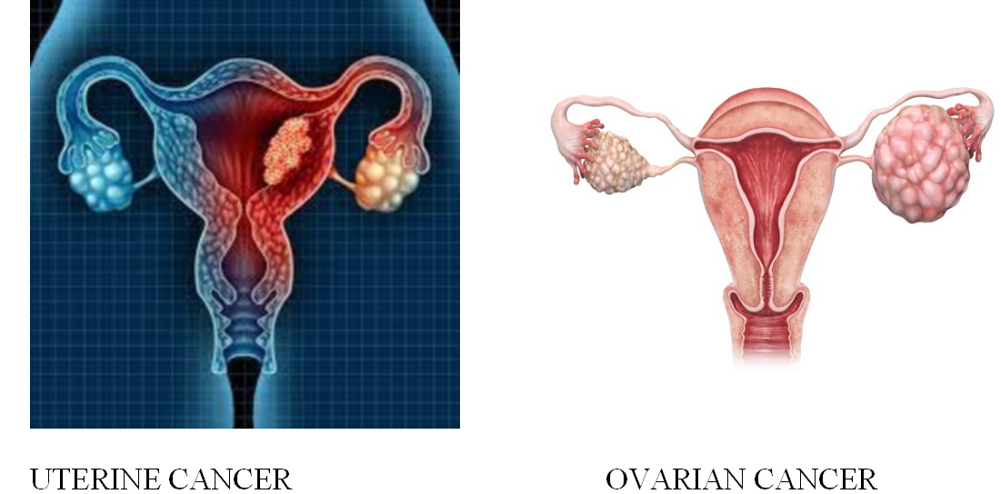 Breast Cancer Treatment in Chennai ,Thyroid  Cancer Treatment in Chennai, Surgical Oncologist Cancer Treatment in Chennai, Gastroenterology  in Chennai, Laparoscopic Surgery in Chennai,  Dentist in Chennai, Dental Clinic in Chennai, Dental in Chennai, Root Canal Treatment in Chennai,  endocrinologist in Chennai, Psychiatrist  in Chennai  Endodontist in Chennai, Breast Cancer Treatment in Purasawalkam Chennai ,Thyroid  Cancer Treatment in Purasawalkam Chennai, Surgical Oncologist Cancer Treatment in Purasawalkam Chennai, Gastroenterology  in Purasawalkam Chennai, Laparoscopic Surgery in Purasawalkam Chennai,  Dentist in Purasawalkam Chennai, Dental Clinic in Purasawalkam Chennai, Dental in Purasawalkam Chennai, Root Canal Treatment in Purasawalkam Chennai,  endocrinologist in Purasawalkam Chennai, Psychiatrist  in Purasawalkam Chennai  Endodontist in Purasawalkam Chennai, Breast Cancer Treatment in Vepery Chennai  ,Thyroid  Cancer Treatment in Vepery Chennai, Surgical Oncologist Cancer Treatment in Vepery Chennai, Gastroenterology  in Vepery Chennai, Laparoscopic Surgery in Vepery Chennai,  Dentist in Vepery Chennai, Dental Clinic in Vepery Chennai, Dental in Vepery Chennai, Root Canal Treatment in Vepery Chennai,  endocrinologist in Vepery Chennai, Psychiatrist  in Vepery Chennai  Endodontist in Vepery Chennai, , Breast Cancer Treatment in kilpauk Chennai  ,Thyroid  Cancer Treatment in kilpauk Chennai, Surgical Oncologist Cancer Treatment in kilpauk Chennai, Gastroenterology  in kilpauk Chennai, Laparoscopic Surgery in kilpauk Chennai,  Dentist in kilpauk Chennai, Dental Clinic in kilpauk Chennai, Dental in kilpauk Chennai, Root Canal Treatment in kilpauk Chennai,  endocrinologist in kilpauk Chennai, Psychiatrist  in kilpauk Chennai,  Endodontist in kilpauk Chennai, Breast Cancer Treatment in kellys Chennai  ,Thyroid  Cancer Treatment in kellys Chennai, Surgical Oncologist Cancer Treatment in kellys Chennai, Gastroenterology  in kellys Chennai, Laparoscopic Surgery in kellys Chennai,  Dentist in kellys Chennai, Dental Clinic in kellys Chennai, Dental in kellys Chennai, Root Canal Treatment in kellys Chennai,  endocrinologist in kellys Chennai, Psychiatrist  in kellys Chennai,  Endodontist in kellys Chennai